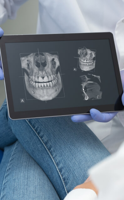 X-ray of teeth and jawbone